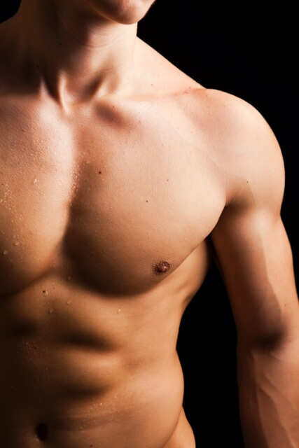 gynecomastie
