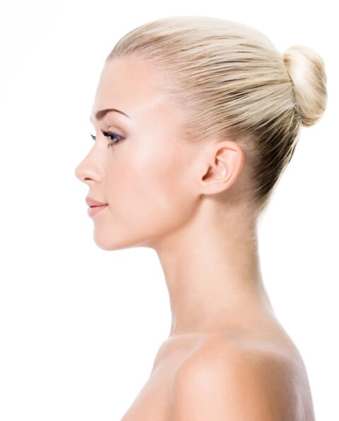 rhinoplastie